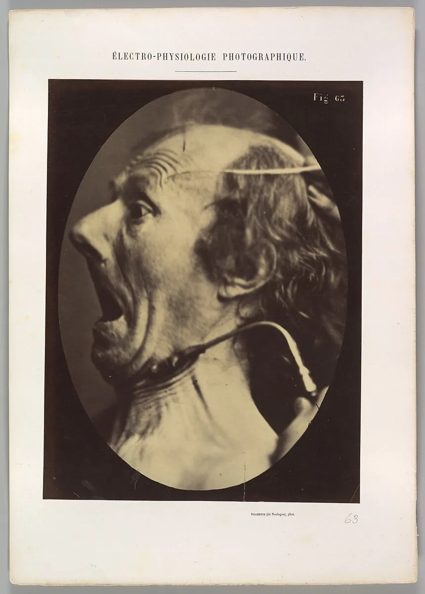 Figure 63: Expression of terror — Guillaume-Benjamin-Amand Duchenne de Boulogne|Adrien Tournachon