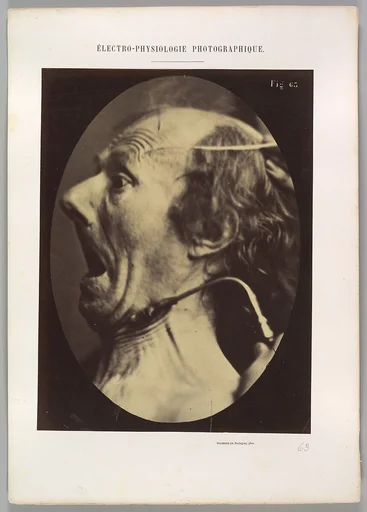 Figure 63: Expression of terror