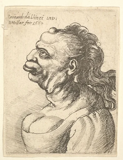 Bust of a woman wearing low-cut dress, with protruding lipd, growth on her forehead, prominent breast, long flowing hair down her back, in profile to left.