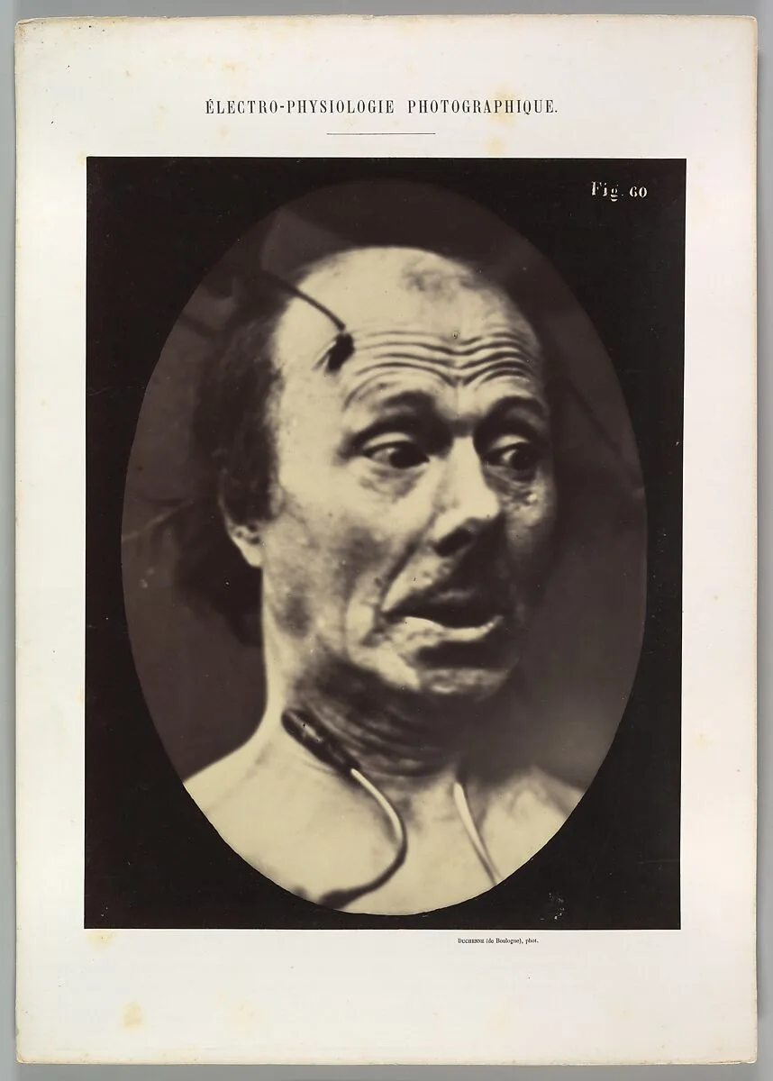 Figure 60: Fright — Guillaume-Benjamin-Amand Duchenne de Boulogne|Adrien Tournachon