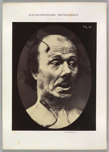 Figure 60: Fright