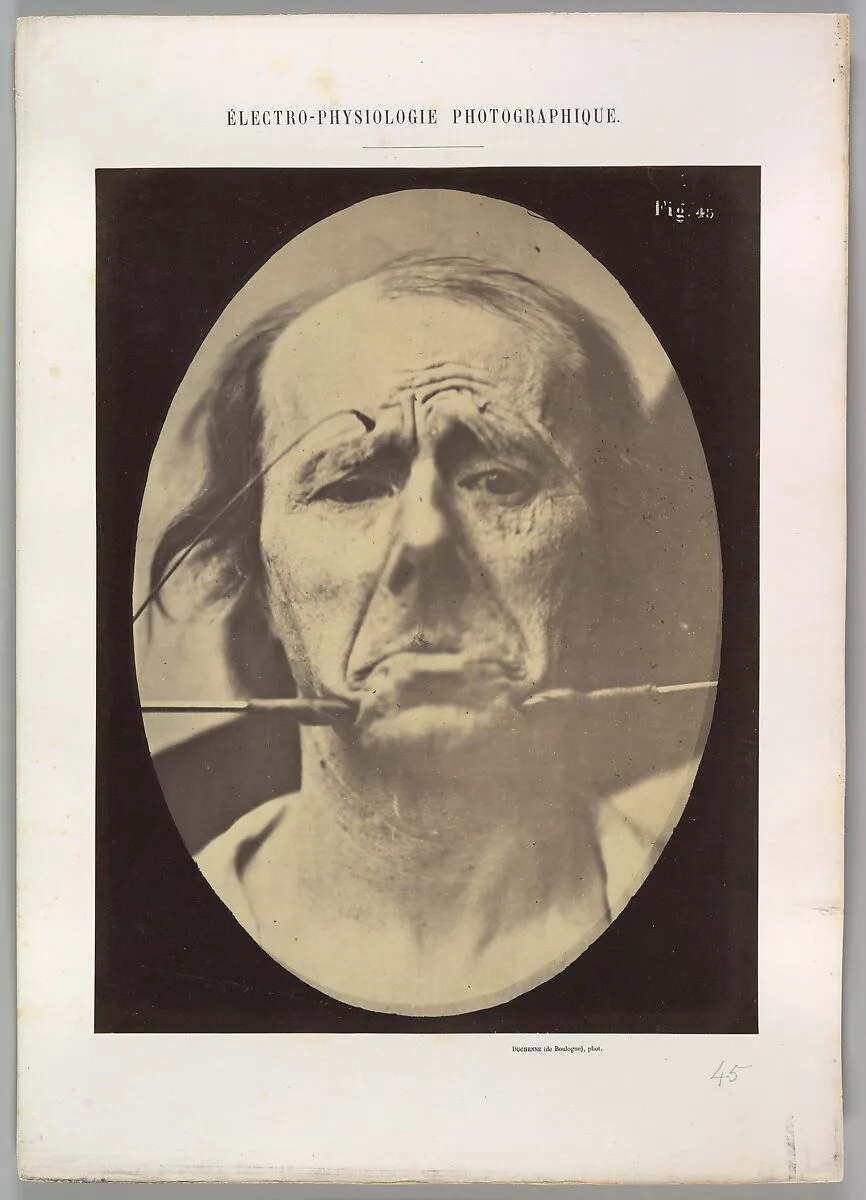 Figure 45: Pain and despair. — Guillaume-Benjamin-Amand Duchenne de Boulogne|Adrien Tournachon