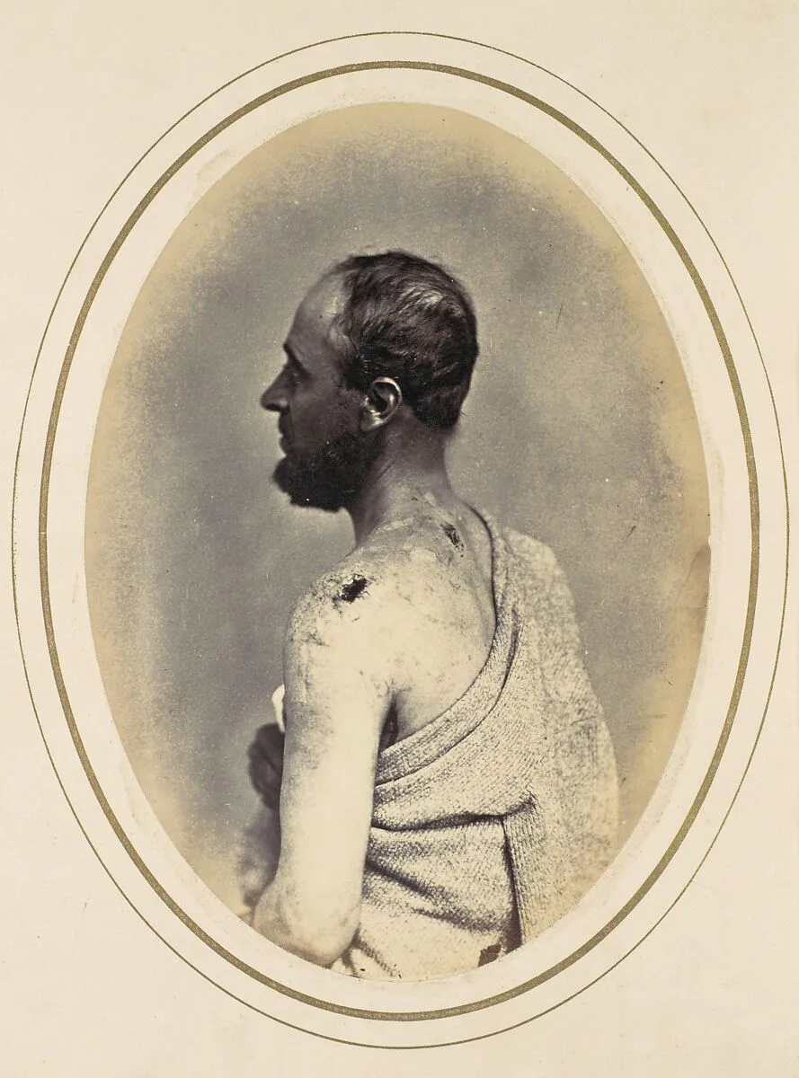 Henry Yon — Reed Brockway Bontecou