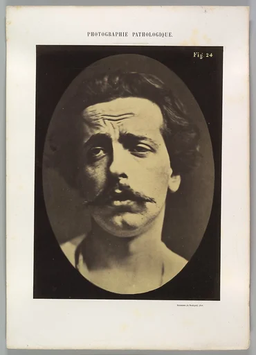 Figure 24: Extreme pain to the point of exhaustion, the head of Christ and memory of love or ecstatic gaze.