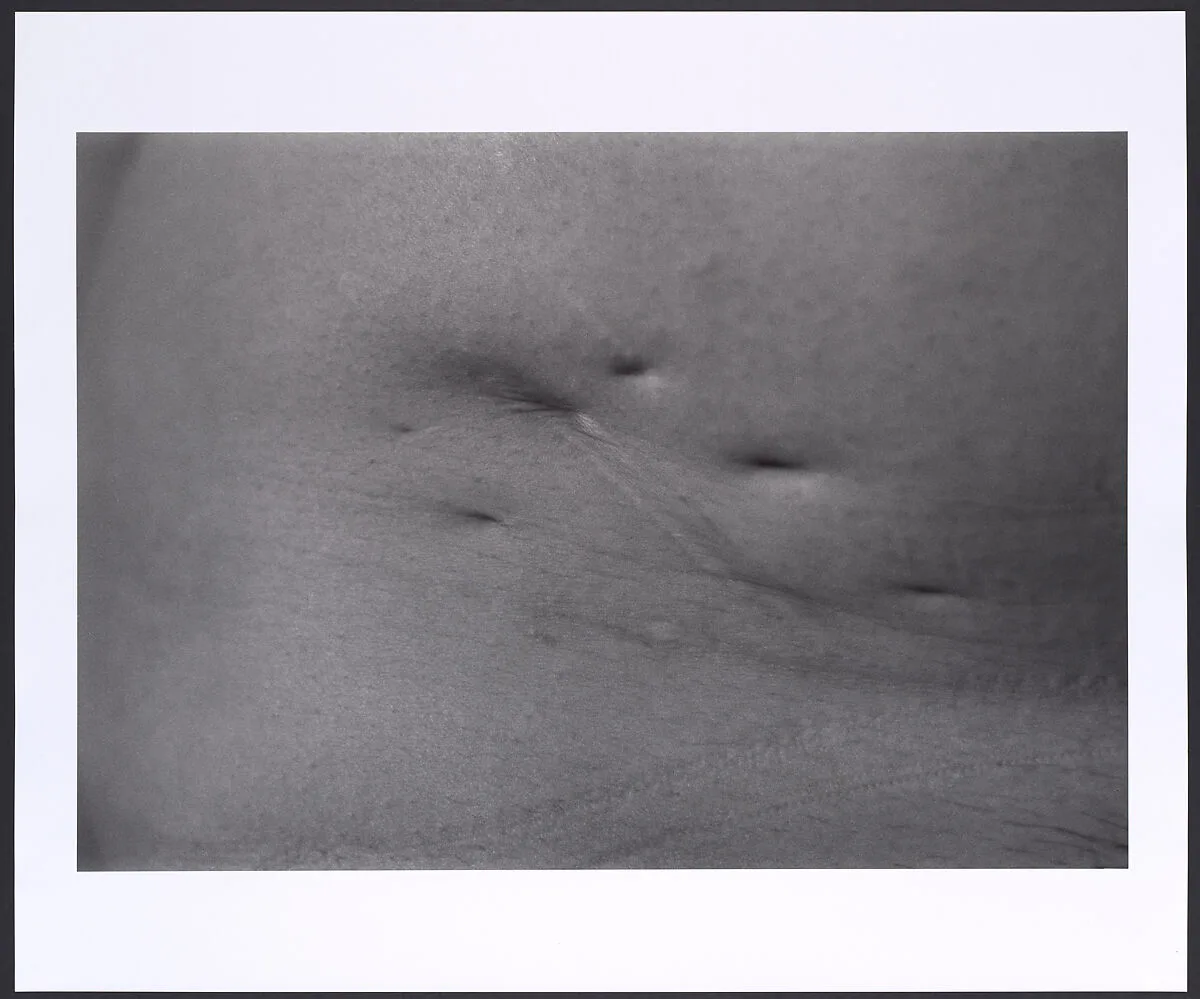 Scar #19, Illness-1964, Kyoto — Ishiuchi Miyako