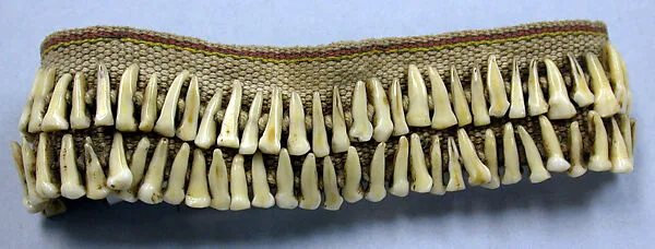 Bracelet — Unknown