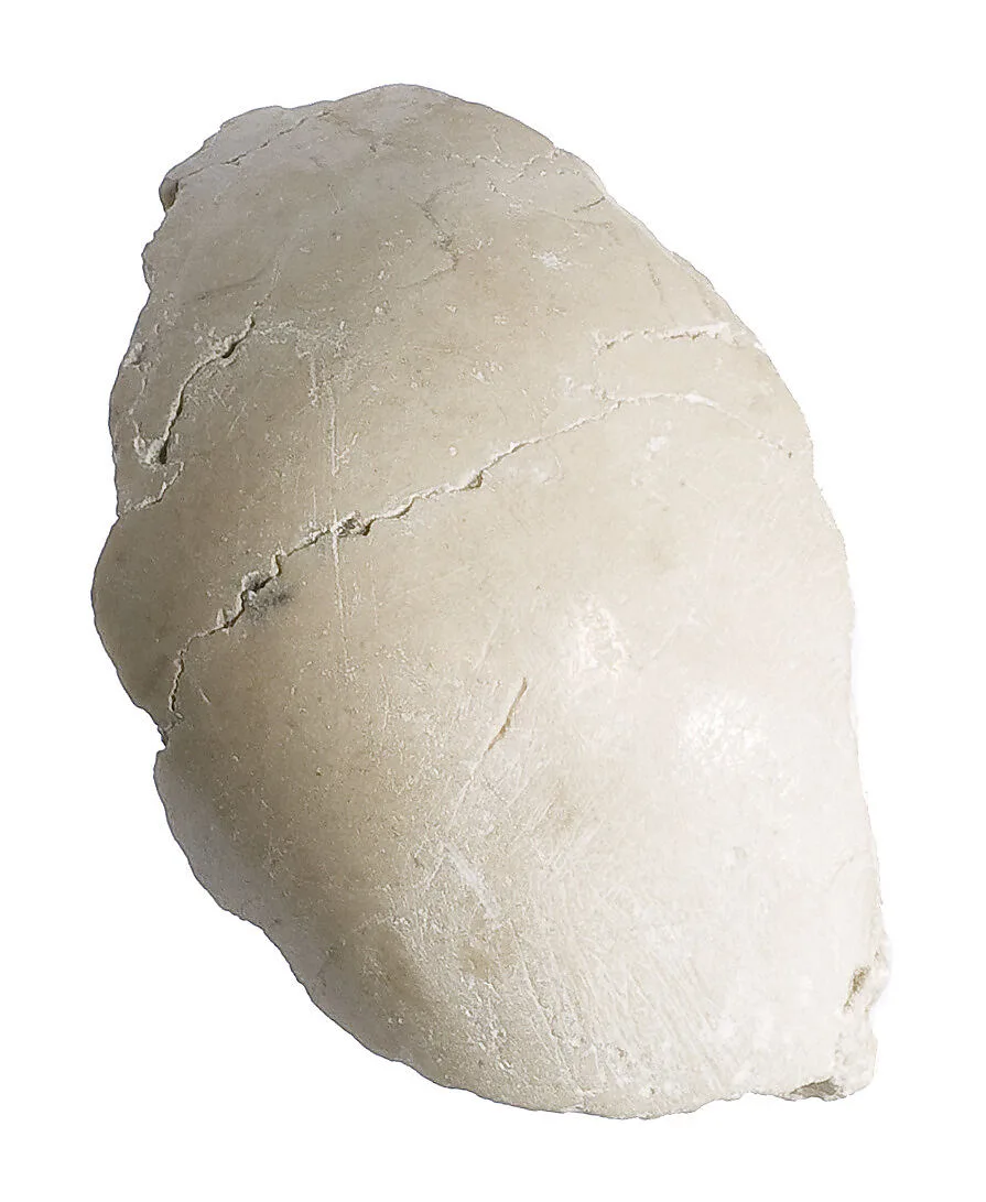 Elbow or shoulder — Unknown