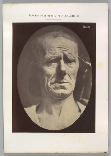 Figure 22: No painful expression