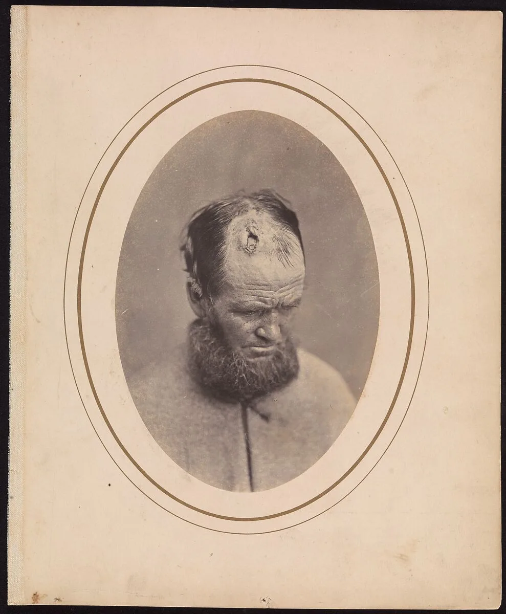 Private John Parkhurst, Company E, Second New York Heavy Artillery — Reed Brockway Bontecou
