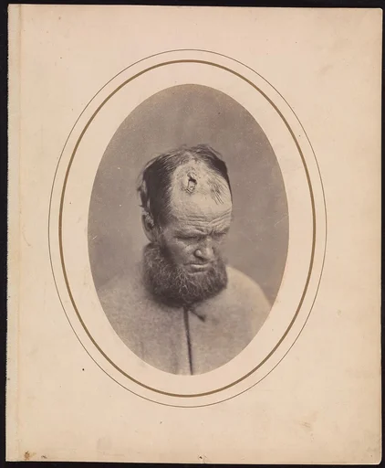Private John Parkhurst, Company E, Second New York Heavy Artillery
