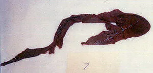 Textile fragment — Unknown
