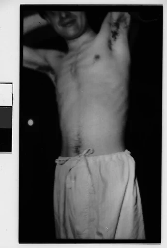 [Hanns Skolle with Arms Raised Over Head, Shirtless]