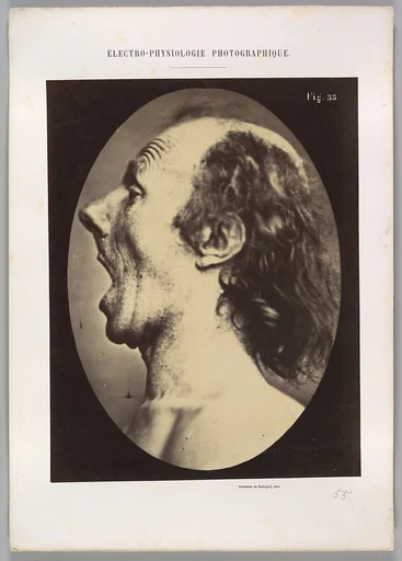 Figure 55: Astonishment badly rendered by the subject: a ridiculous and inane expression.