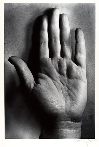 [Hand]