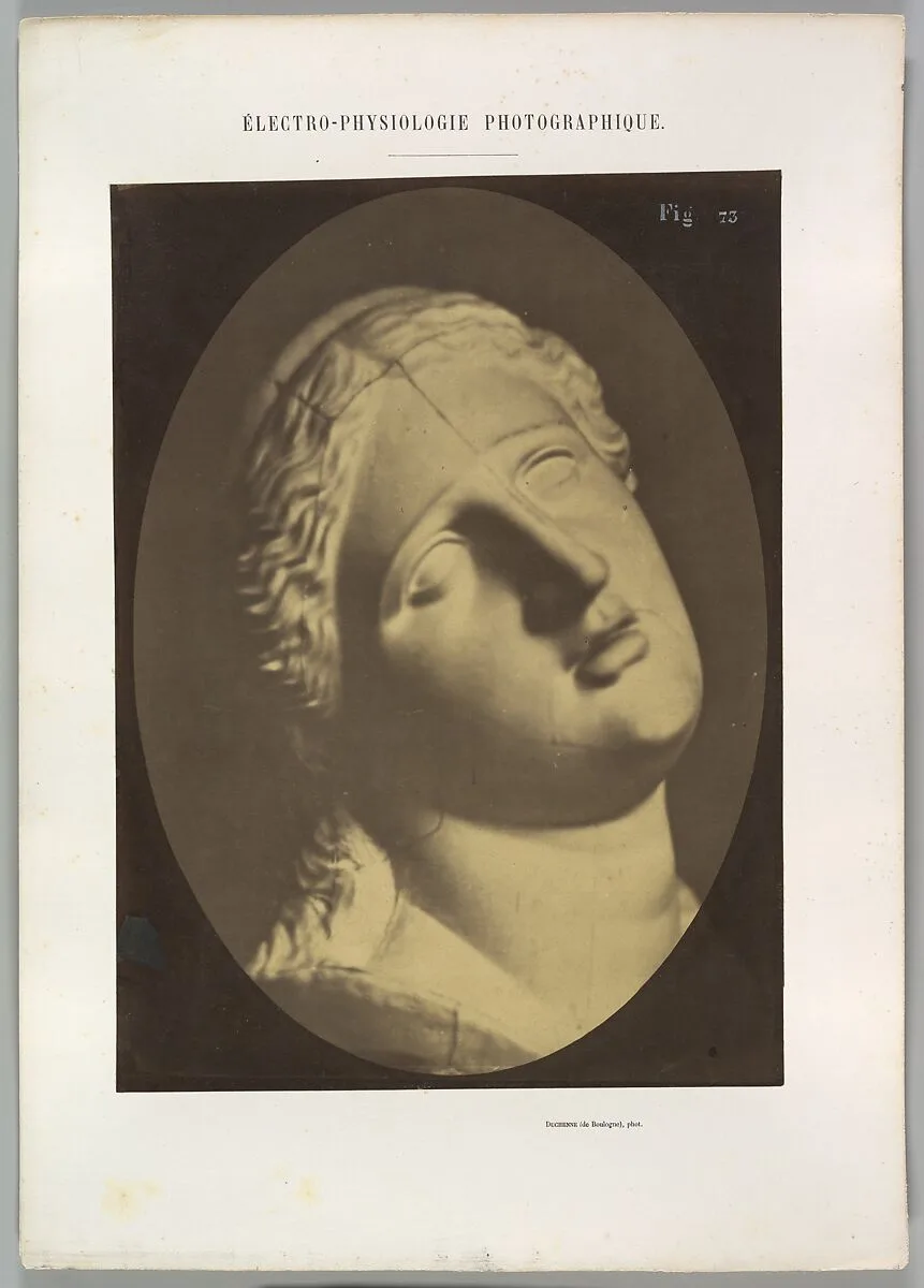 Figure 73: Head of Niobe — Guillaume-Benjamin-Amand Duchenne de Boulogne|Adrien Tournachon