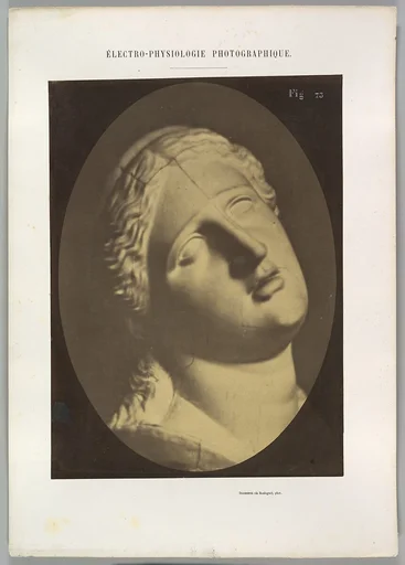 Figure 73: Head of Niobe
