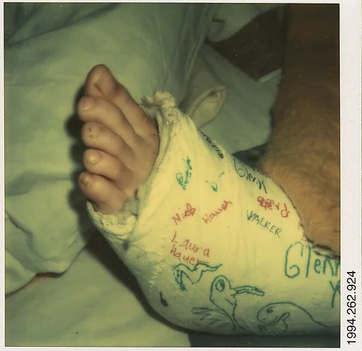 [Foot in Cast: Glenn Ives?]