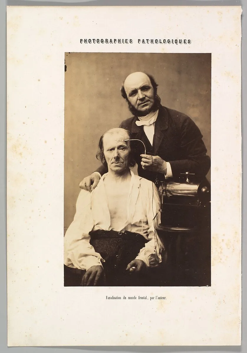 Faradisation du muscle frontal — Guillaume-Benjamin-Amand Duchenne de Boulogne|Adrien Tournachon