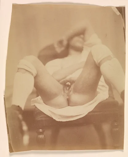 Hermaphrodite