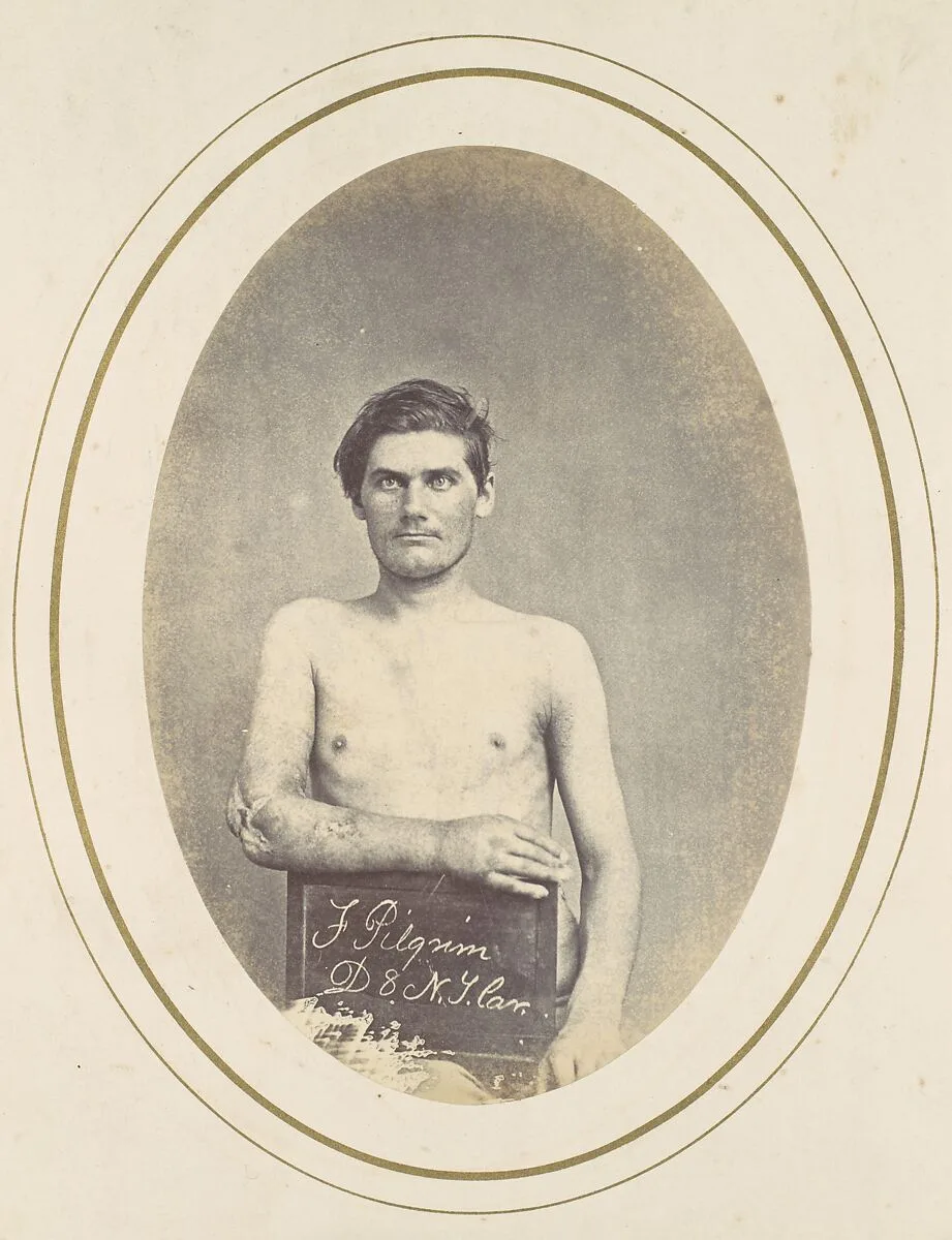 Frederick Pilgrim — Reed Brockway Bontecou