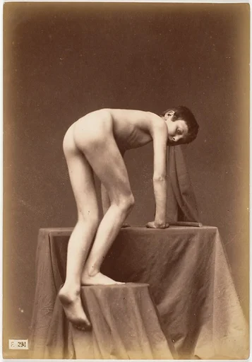 [Young Boy, Nude, From the Back, Climbing]