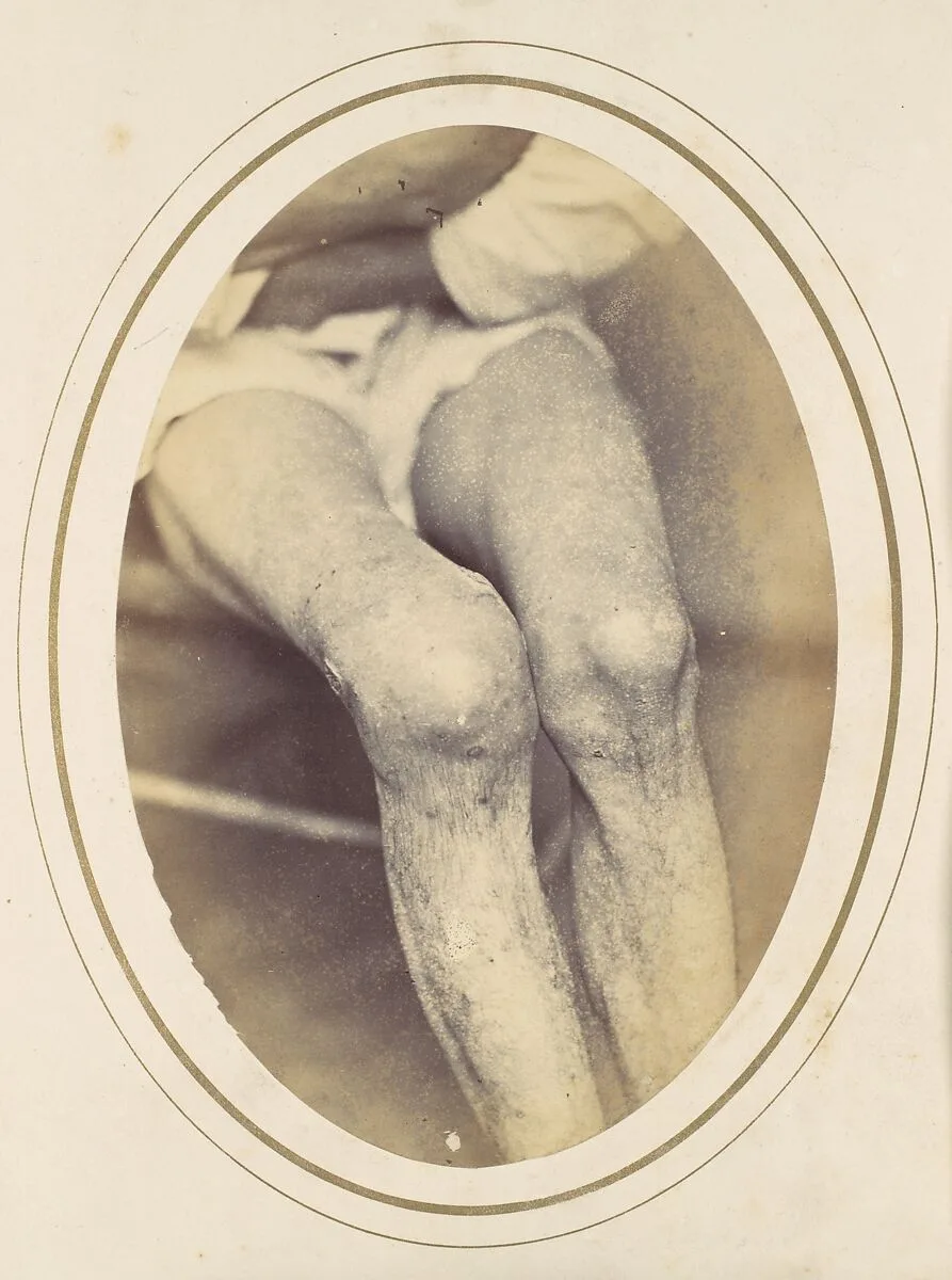 Frederick Hohmann — Reed Brockway Bontecou