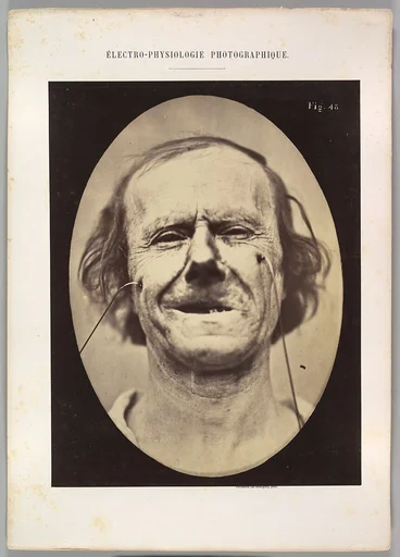 Figure 48: Mild weeping, pity and feeble false laughter