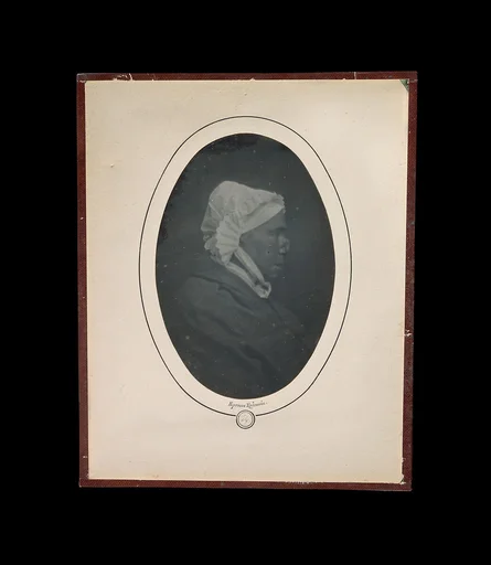 [Profile of a Woman with Necrosis of the Nose]