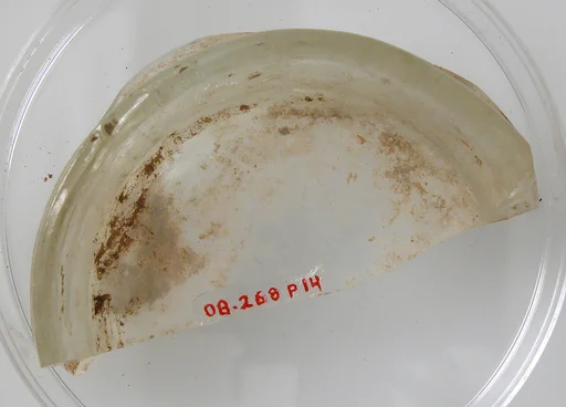 Foot of a Vessel